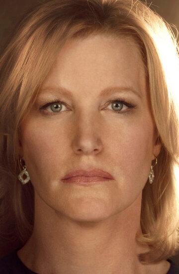 Anna Gunn