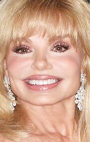 Loni Anderson